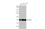 PSAT1 Antibody in Western Blot (WB)