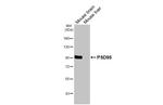 PSD-95 Antibody in Western Blot (WB)