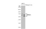 Nectin 4 Recombinant Rabbit Monoclonal Antibody (HL2758)