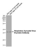 RSV M Protein Antibody in Western Blot (WB)