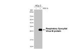 RSV M Protein Antibody in Western Blot (WB)