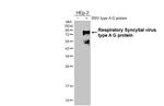 RSV Type A Glycoprotein G Antibody in Western Blot (WB)