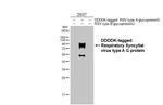 RSV Type A Glycoprotein G Recombinant Rabbit Monoclonal Antibody (HL3122)