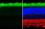 Rhodopsin Antibody in Immunohistochemistry (Paraffin) (IHC (P))