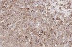 ROBO1 Antibody in Immunohistochemistry (Paraffin) (IHC (P))