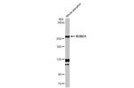 ROBO1 Antibody in Western Blot (WB)