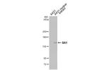 STAG1 Recombinant Rabbit Monoclonal Antibody (HL3139)