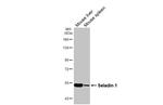 DHCR24 Antibody in Western Blot (WB)