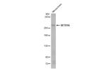 SETD1A Antibody in Western Blot (WB)