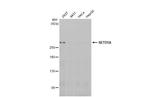 SETD1A Recombinant Rabbit Monoclonal Antibody (HL2707)