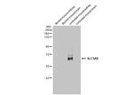 SLC5A8 Antibody in Western Blot (WB)