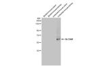 SLC5A8 Antibody in Western Blot (WB)