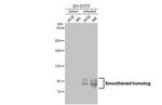 SMO Antibody in Western Blot (WB)