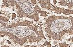 SSTR2 Antibody in Immunohistochemistry (Paraffin) (IHC (P))