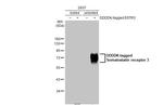 SSTR3 Antibody in Western Blot (WB)