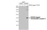 SSTR4 Antibody in Western Blot (WB)