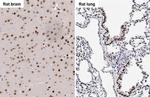SOX2 Antibody in Immunohistochemistry (Paraffin) (IHC (P))