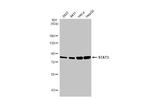 STAT3 Antibody in Western Blot (WB)