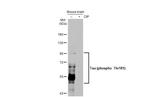 Phospho-Tau (Thr181) Antibody in Western Blot (WB)