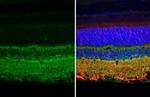 Tau Antibody in Immunohistochemistry (Paraffin) (IHC (P))