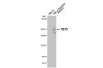 TET2 Recombinant Rabbit Monoclonal Antibody (HL2822)