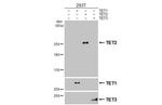 TET2 Antibody in Western Blot (WB)