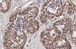 TIGIT Antibody in Immunohistochemistry (Paraffin) (IHC (P))