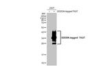 TIGIT Antibody in Western Blot (WB)