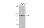 TSC2 Antibody in Western Blot (WB)