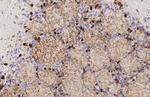 Tyrosine Hydroxylase Antibody in Immunohistochemistry (Paraffin) (IHC (P))