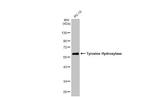Tyrosine Hydroxylase Antibody in Western Blot (WB)