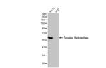 Tyrosine Hydroxylase Antibody in Western Blot (WB)