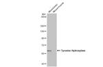 Tyrosine Hydroxylase Antibody in Western Blot (WB)