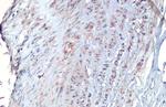 Vimentin Antibody in Immunohistochemistry (Paraffin) (IHC (P))