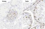 Vimentin Antibody in Immunohistochemistry (Paraffin) (IHC (P))