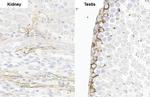 Vimentin Antibody in Immunohistochemistry (Paraffin) (IHC (P))