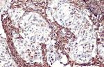 Vimentin Antibody in Immunohistochemistry (Paraffin) (IHC (P))