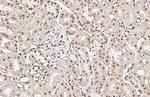 XPC Recombinant Rabbit Monoclonal Antibody (HL2894)