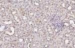 XPC Antibody in Immunohistochemistry (Paraffin) (IHC (P))