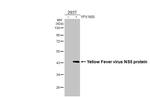 Yellow Fever Virus NS5 (strain 17D vaccine) Recombinant Rabbit Monoclonal Antibody (HL2916)