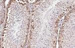 YTHDF2 Antibody in Immunohistochemistry (Paraffin) (IHC (P))