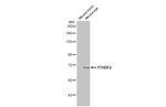 YTHDF2 Antibody in Western Blot (WB)