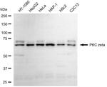 PKC zeta Antibody in Western Blot (WB)