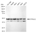 PTP1B/PTPN2 Recombinant Rabbit Monoclonal Antibody (24GB1130)