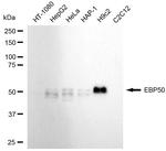 EBP50 Recombinant Rabbit Monoclonal Antibody (24GB1270)