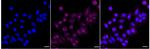 ACACB Recombinant Rabbit Monoclonal Antibody (24GB3230)