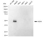 ADH4 Antibody in Western Blot (WB)