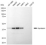 Aprataxin Recombinant Rabbit Monoclonal Antibody (24GB6830)