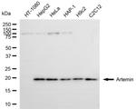 Artemin Recombinant Rabbit Monoclonal Antibody (24GB6845)