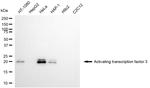 ATF3 Recombinant Rabbit Monoclonal Antibody (24GB6930)